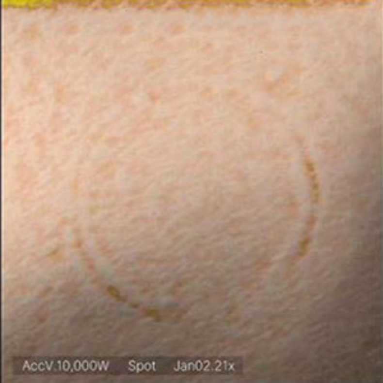 A microscopic view of a skin pore after using the Naqaa Collagen Mask, showing the circular impression filled with beneficial collagen