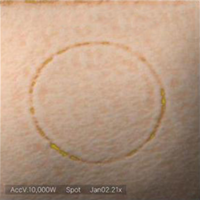 A microscopic view of a skin pore before using the Naqaa Collagen Mask, showing a faint circular impression